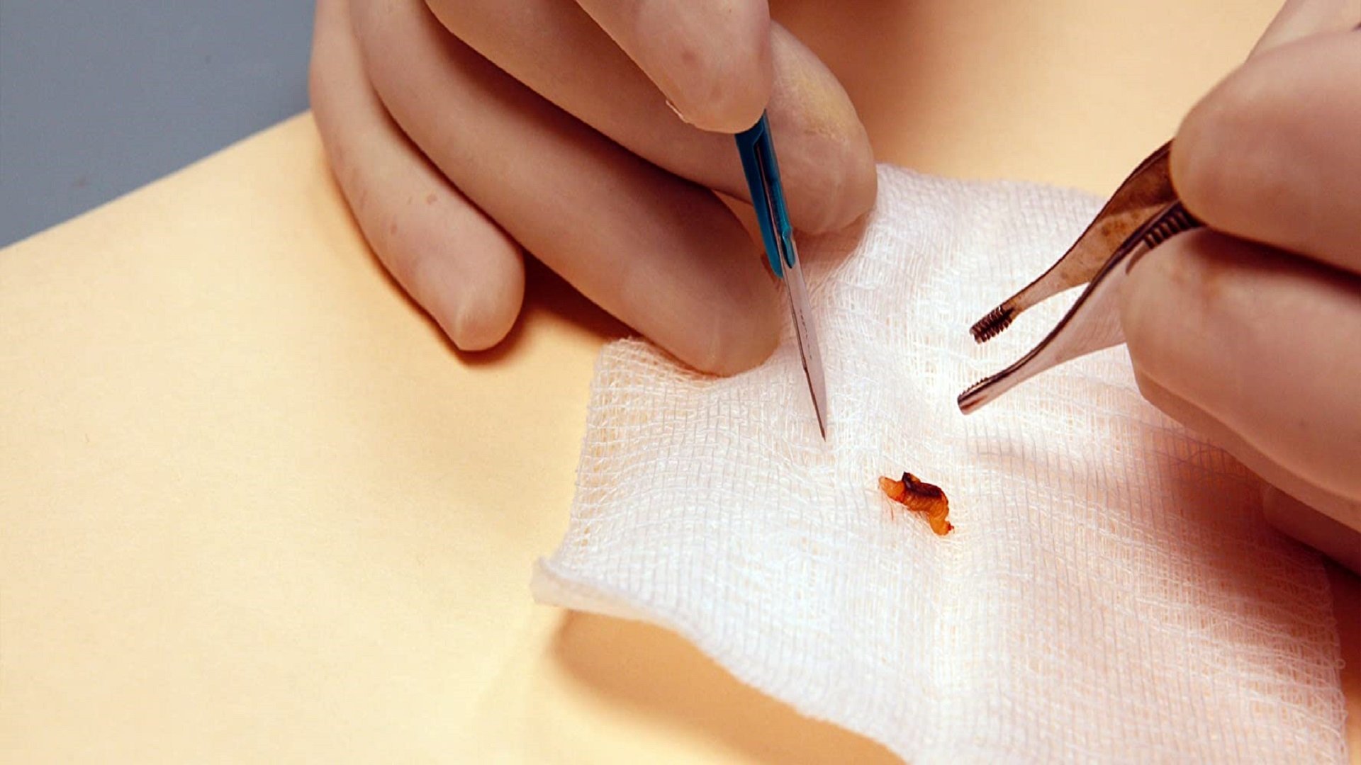 Patient Seventeen Background